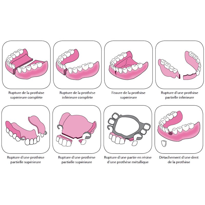 Colle dentaire longue durée AJUSDENT 1 an pour les dentiers