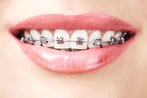 orthodontiste