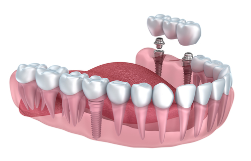 Comment choisir et trouver un bon dentiste?